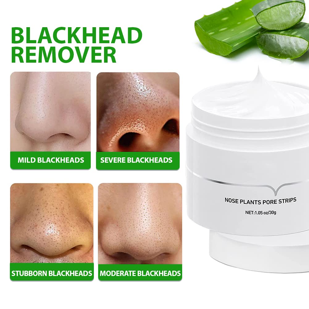 severe blackheads removal